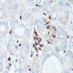 CD45 Antibody in Immunohistochemistry (Paraffin) (IHC (P))
