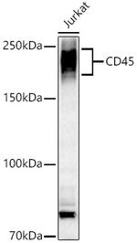 CD45 Antibody in Western Blot (WB)