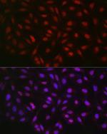 LKB1 Antibody in Immunocytochemistry (ICC/IF)
