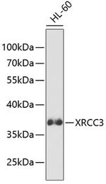 XRCC3 Polyclonal Antibody
