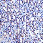 LETMD1 Polyclonal Antibody