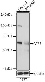 ATF Polyclonal Antibody