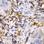 HCLS1 Polyclonal Antibody