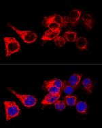 Cytokeratin 17 Polyclonal Antibody