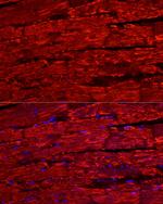 BNP Polyclonal Antibody