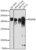 PDGFRB Antibody in Western Blot (WB)