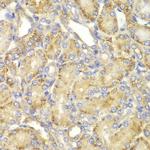 PPP2R2A Antibody in Immunohistochemistry (Paraffin) (IHC (P))