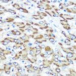 Presenilin 1 Antibody in Immunohistochemistry (Paraffin) (IHC (P))
