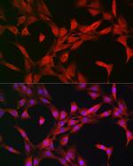 p70 S6 Kinase Polyclonal Antibody