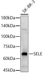 CD62E (E-selectin) Polyclonal Antibody