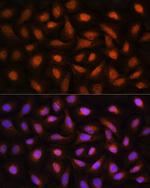 CtBP2 Antibody in Immunocytochemistry (ICC/IF)