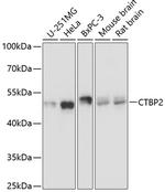 CtBP2 Antibody in Western Blot (WB)