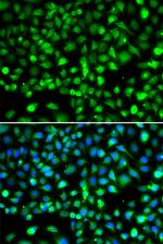 SMYD1 Polyclonal Antibody