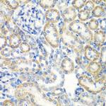 SMYD1 Antibody in Immunohistochemistry (Paraffin) (IHC (P))