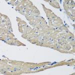 SMYD1 Antibody in Immunohistochemistry (Paraffin) (IHC (P))