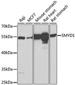 SMYD1 Antibody in Western Blot (WB)