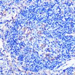 CD86 Antibody in Immunohistochemistry (Paraffin) (IHC (P))