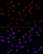 H3K4me2 Polyclonal Antibody