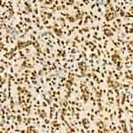 H3K36me3 Antibody in Immunohistochemistry (Paraffin) (IHC (P))