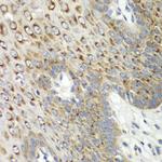 CDK1 Antibody in Immunohistochemistry (Paraffin) (IHC (P))