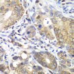 CDK1 Antibody in Immunohistochemistry (Paraffin) (IHC (P))