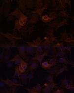 Filamin B Antibody in Immunocytochemistry (ICC/IF)