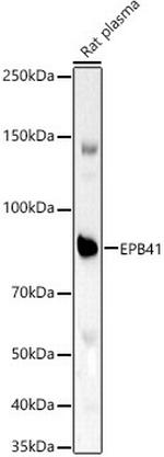EPB41 Polyclonal Antibody