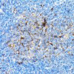 SIAH1 Antibody in Immunohistochemistry (Paraffin) (IHC (P))