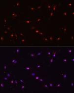 ILF3 Antibody in Immunocytochemistry (ICC/IF)