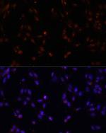 ILF3 Polyclonal Antibody