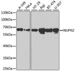 NUP62 Polyclonal Antibody