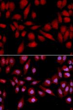 PSMA2 Polyclonal Antibody