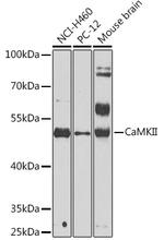 CaMKII beta Polyclonal Antibody