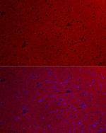 GNAO1 Antibody in Immunocytochemistry (ICC/IF)