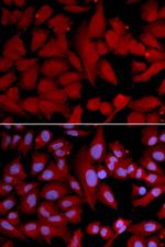 PSMA4 Polyclonal Antibody