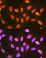 PCBP2 Antibody in Immunocytochemistry (ICC/IF)