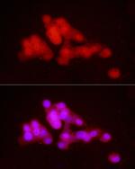 PCBP2 Antibody in Immunocytochemistry (ICC/IF)
