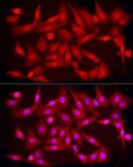 PCBP2 Polyclonal Antibody