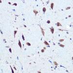 PCBP2 Antibody in Immunohistochemistry (Paraffin) (IHC (P))