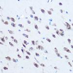 PCBP2 Antibody in Immunohistochemistry (Paraffin) (IHC (P))
