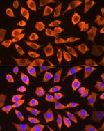 RPS3 Antibody in Immunocytochemistry (ICC/IF)