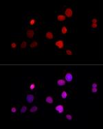LAP2 Antibody in Immunocytochemistry (ICC/IF)
