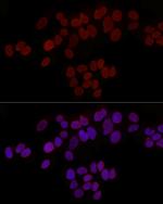 LAP2 Antibody in Immunocytochemistry (ICC/IF)