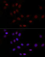LAP2 Polyclonal Antibody