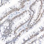 LAP2 Antibody in Immunohistochemistry (Paraffin) (IHC (P))