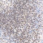 LAP2 Antibody in Immunohistochemistry (Paraffin) (IHC (P))