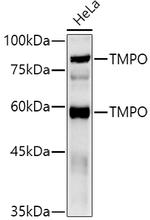 LAP2 Antibody in Western Blot (WB)
