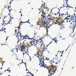 CD61 Polyclonal Antibody