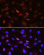 PLK1 Antibody in Immunocytochemistry (ICC/IF)