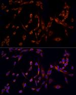 MMP14 Antibody in Immunocytochemistry (ICC/IF)